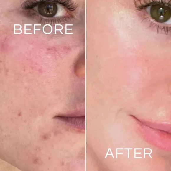 KOA LIFE VITAMIN C BRIGHTENING CLEANSER - Picture 3 of 5